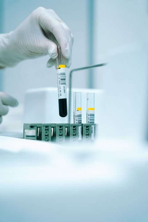 Gloved hand holding a blood sample tube above a laboratory rack