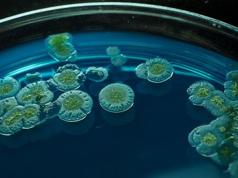 Microbial colonies growing on blue agar in a Petri dish